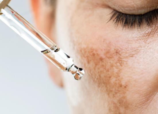 Les causes des taches brunes : Comment les éviter et les traiter