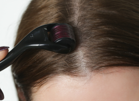 Les bienfaits du microneedling capillaire pour stimuler la repousse